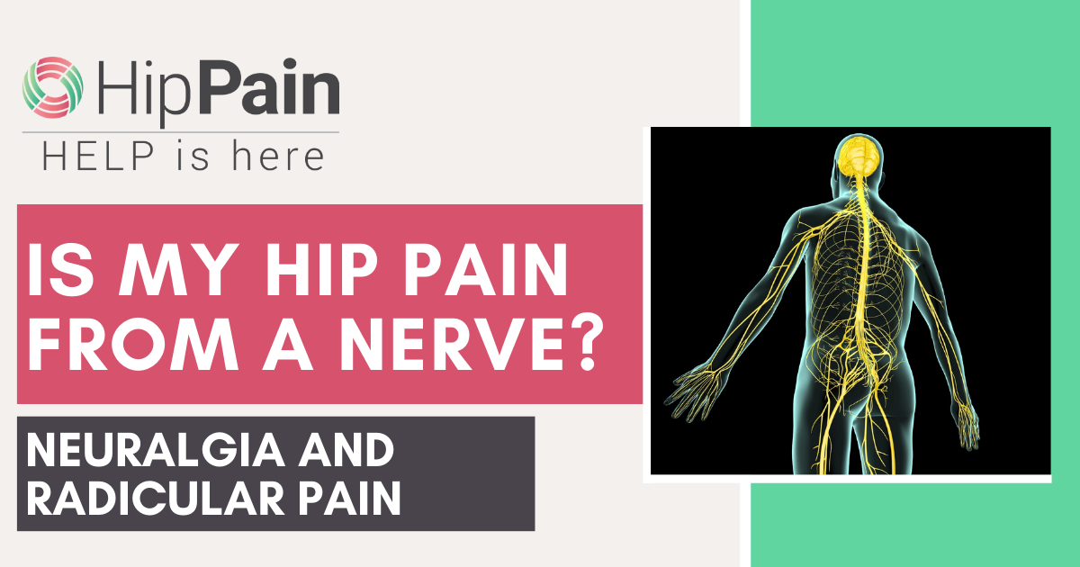 is my hip pain from a nerve, neuralgia and radicular pain