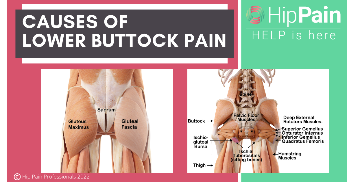 causes of lower buttock pain