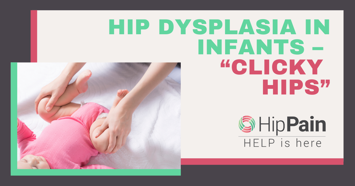 hip dysplasia in infants froggy position