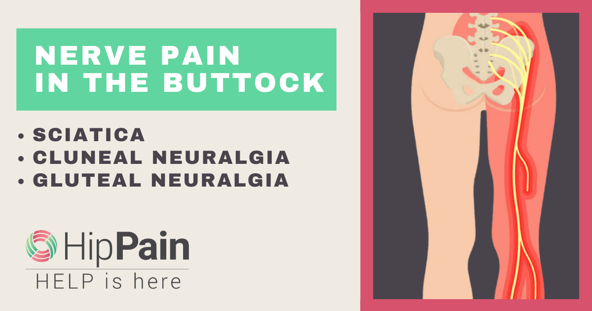 buttock nerve pain scaitica cluneal nerve and gluteal nerves and neuralgia